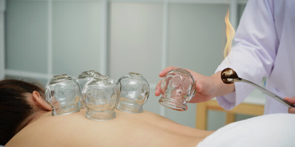 Lekarz stawia bańki pacjetnce